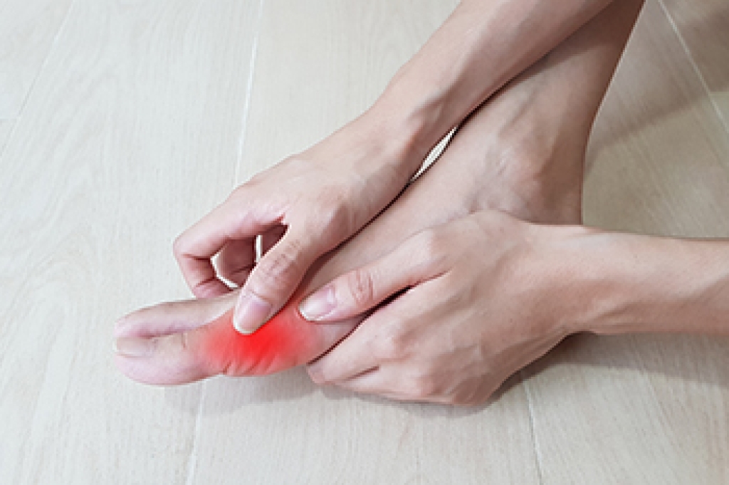 What is Gout?