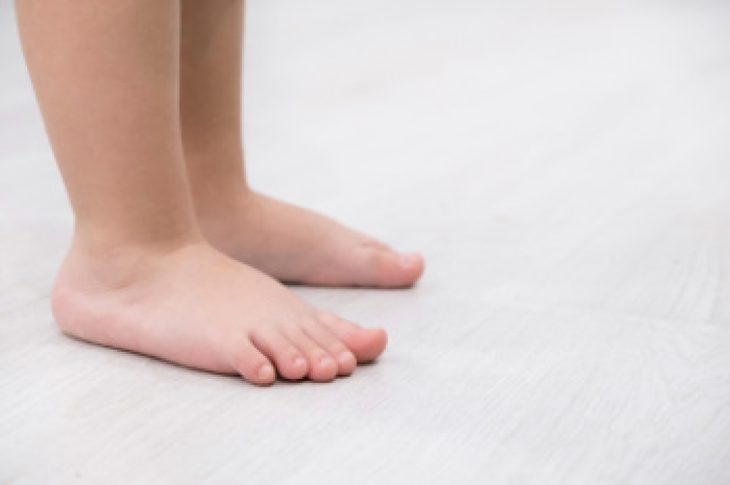 Orthotics and Flexible Flat Feet in Children